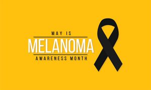 Melanoma and skin cancer